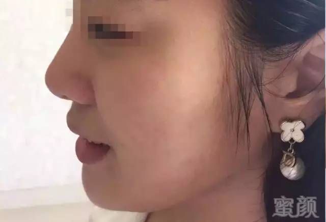 https://img.miyanlife.com/mnt/timg/190510/1106105013-0.jpg