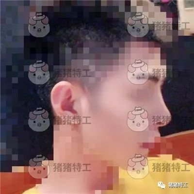 https://img.miyanlife.com/mnt/timg/190510/1143441604-2.jpg 案例图片