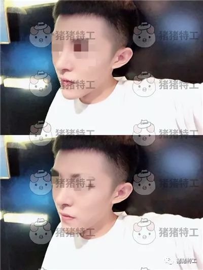 https://img.miyanlife.com/mnt/timg/190510/114345M41-6.jpg 案例图片