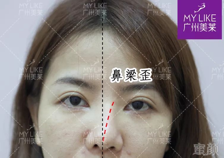https://img.miyanlife.com/mnt/timg/190512/104I34Y7-1.jpg