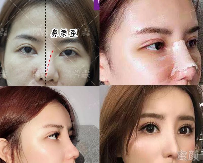 https://img.miyanlife.com/mnt/timg/190512/104P14546-9.jpg
