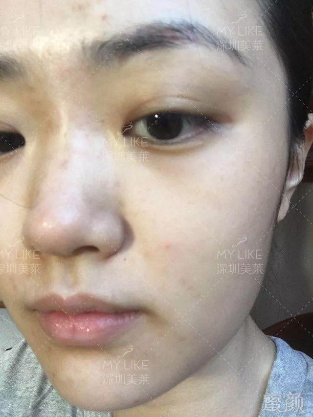 https://img.miyanlife.com/mnt/timg/190512/1052232458-13.jpg