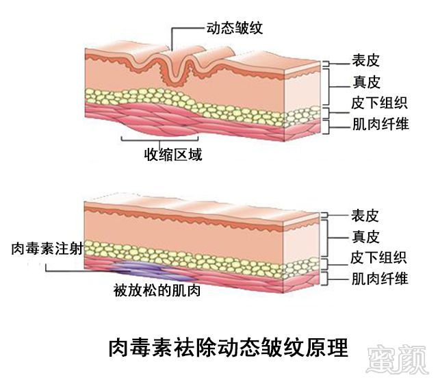 https://img.miyanlife.com/mnt/timg/190515/1120401I3-1.jpg