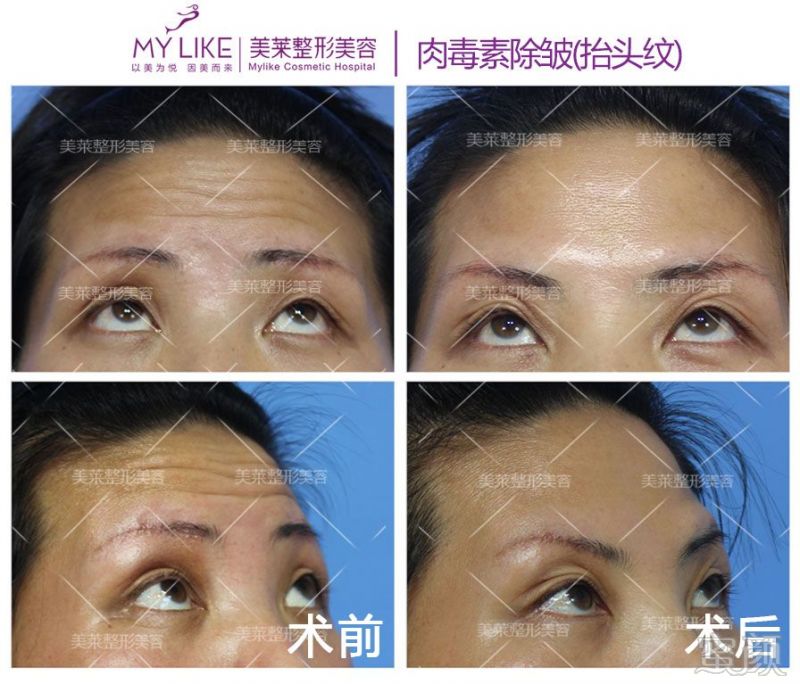 https://img.miyanlife.com/mnt/timg/190515/1120405415-2.jpg