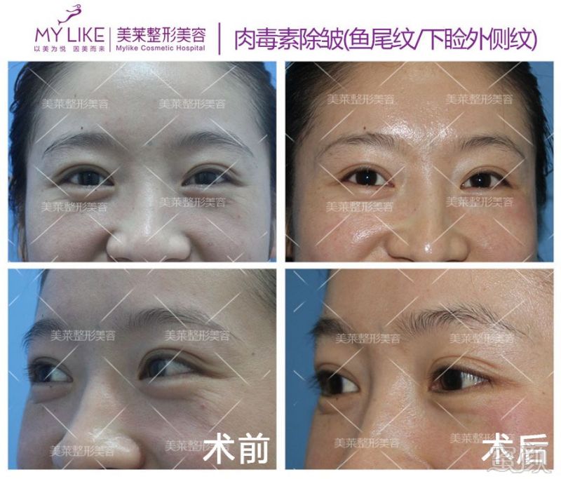 https://img.miyanlife.com/mnt/timg/190515/11204153B-8.jpg