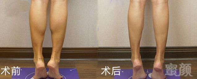 https://img.miyanlife.com/mnt/timg/190515/1120422248-9.jpg