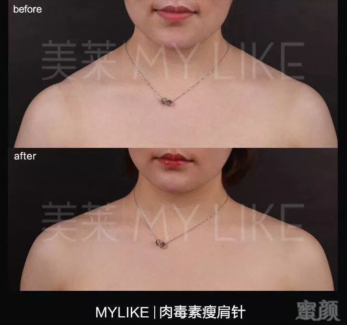 https://img.miyanlife.com/mnt/timg/190515/1120424G7-10.jpg