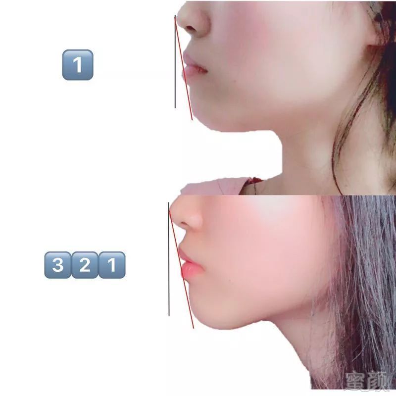 https://img.miyanlife.com/mnt/timg/190515/1139254251-7.jpg