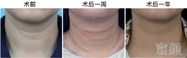 https://img.miyanlife.com/mnt/timg/190516/1212194092-15.jpg