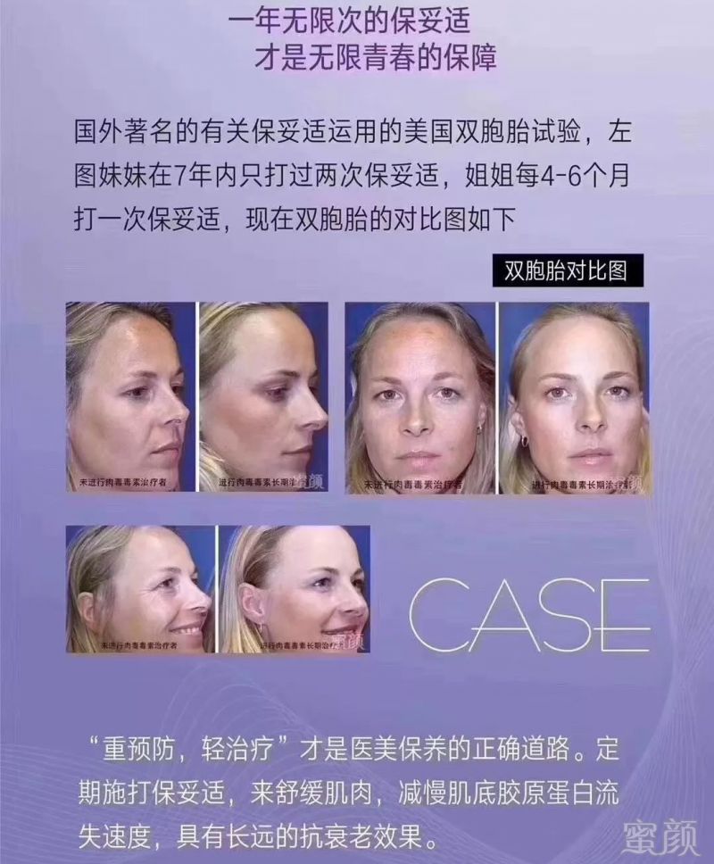 https://img.miyanlife.com/mnt/timg/190516/12142Q503-0.jpg
