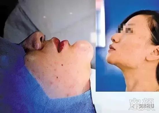 https://img.miyanlife.com/mnt/timg/190516/1231024I4-4.jpg