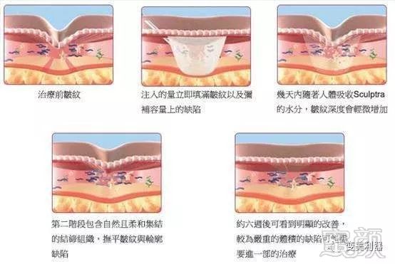 https://img.miyanlife.com/mnt/timg/190516/123104K57-11.jpg