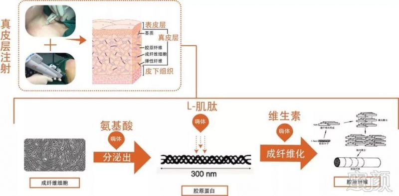 案例图片