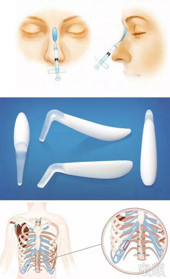 https://img.miyanlife.com/mnt/timg/190517/114I5NI-3.jpg