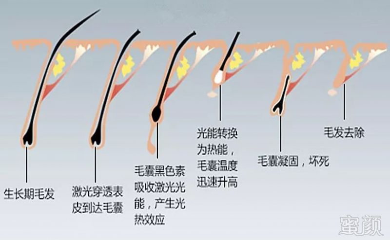 案例图片