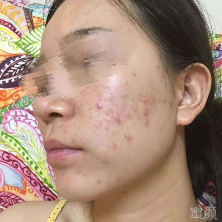 https://img.miyanlife.com/mnt/timg/190519/1110521621-1.jpg
