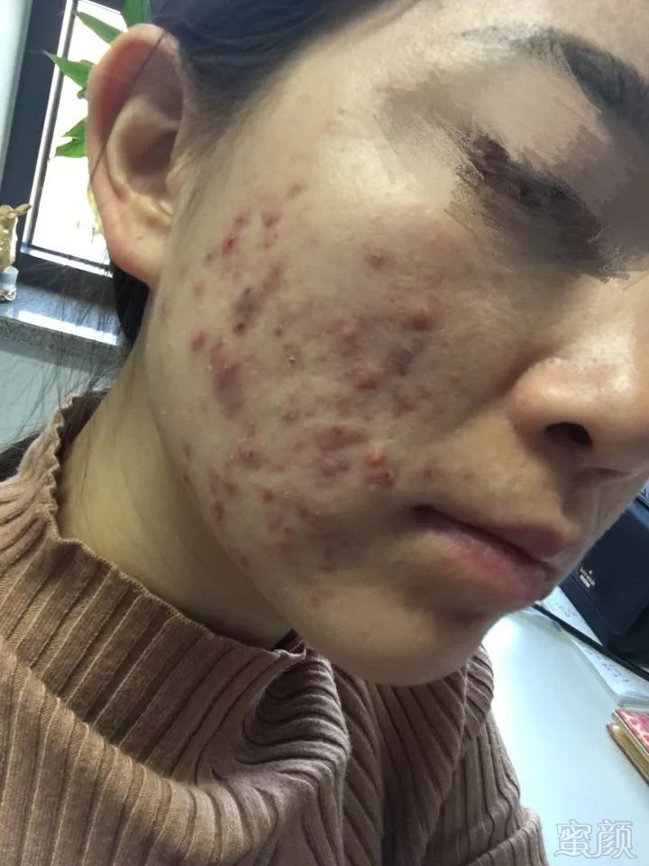 https://img.miyanlife.com/mnt/timg/190519/1111063439-15.jpg