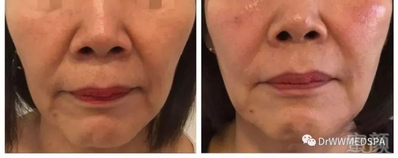 https://img.miyanlife.com/mnt/timg/190519/113401L23-3.jpg