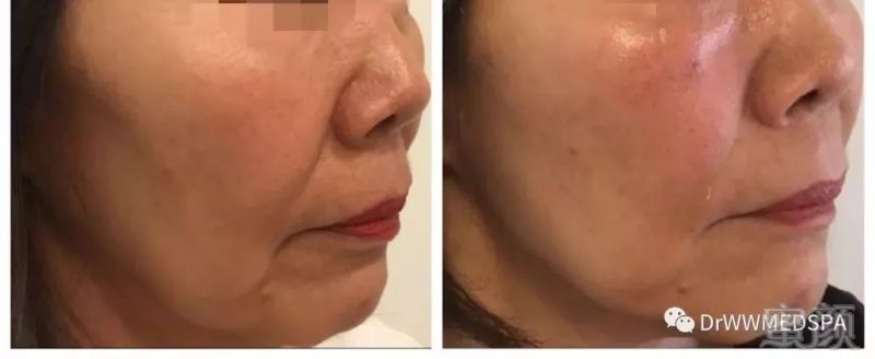 https://img.miyanlife.com/mnt/timg/190519/113401O24-4.jpg