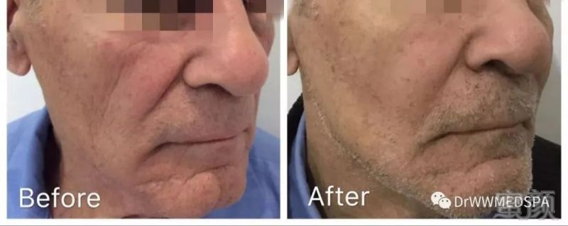 https://img.miyanlife.com/mnt/timg/190519/113403E20-6.jpg