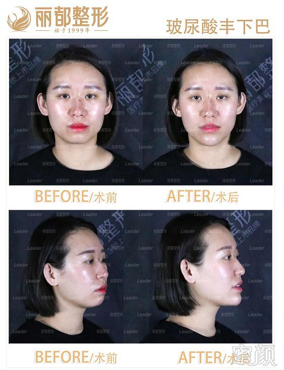 https://img.miyanlife.com/mnt/timg/190521/1211153232-1.jpg