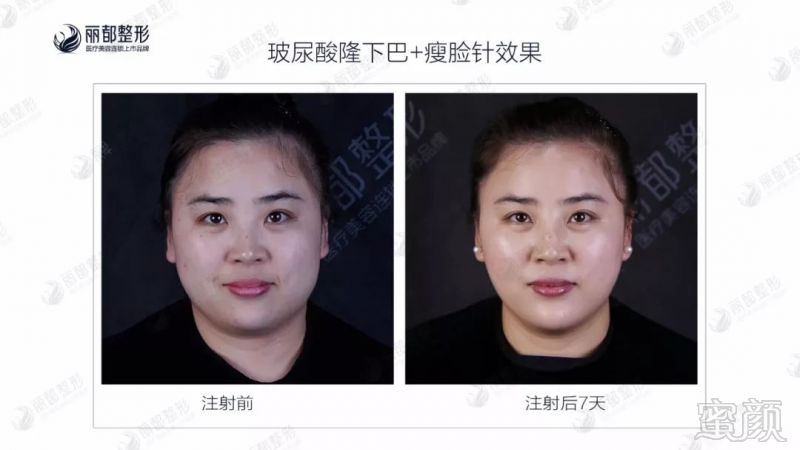 https://img.miyanlife.com/mnt/timg/190521/12111K431-4.jpg