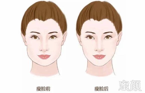 https://img.miyanlife.com/mnt/timg/190521/12111K5Z-3.jpg