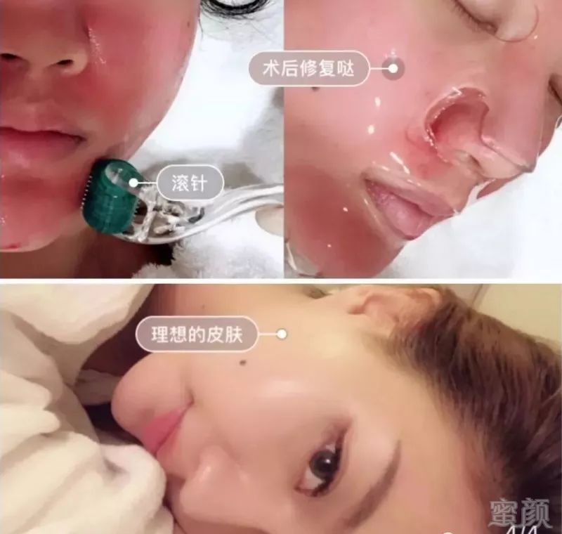 https://img.miyanlife.com/mnt/timg/190522/1151161a0-1.jpg