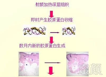 https://img.miyanlife.com/mnt/timg/190522/1154035309-3.jpg