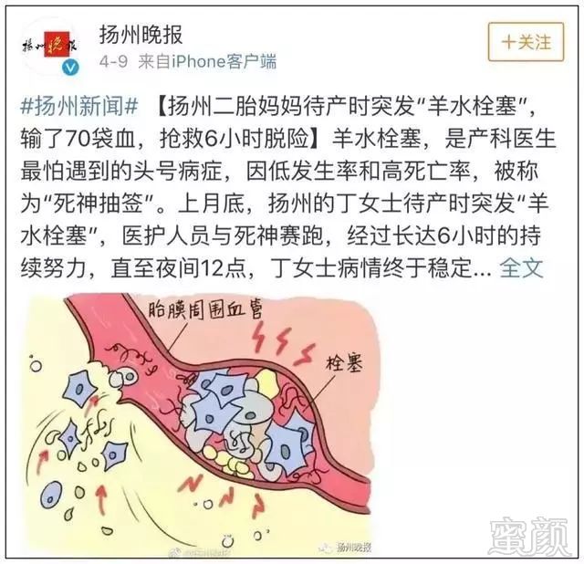 案例图片