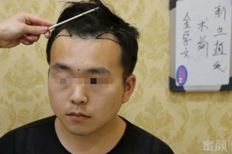 案例图片