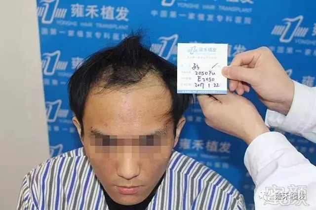 案例图片