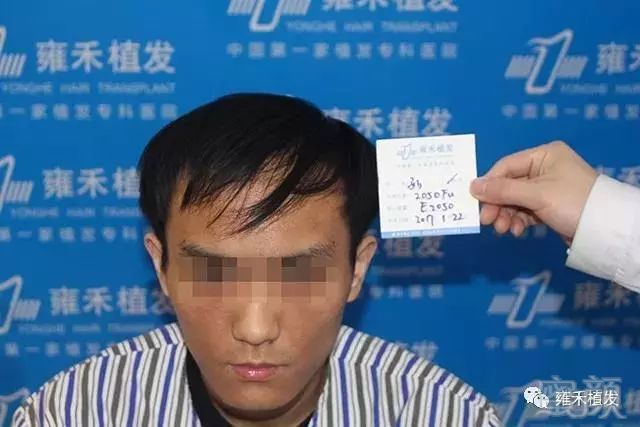 案例图片