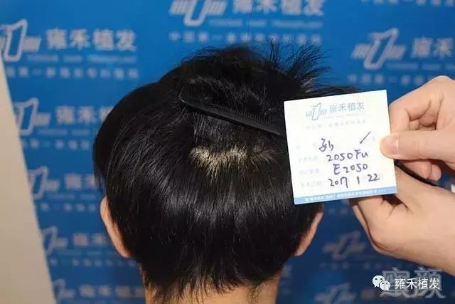 案例图片