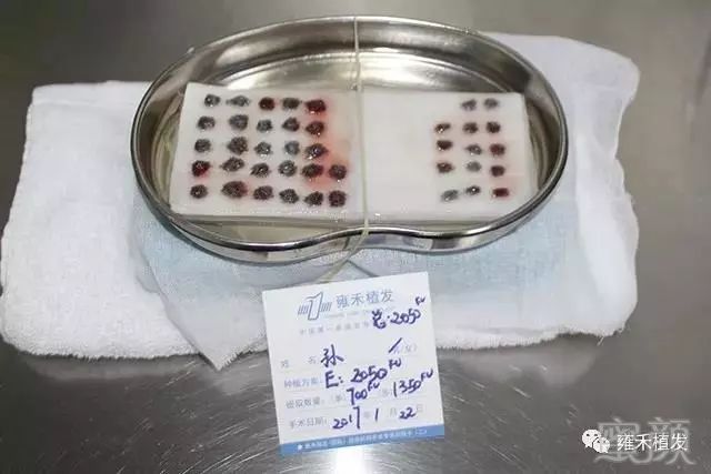 案例图片