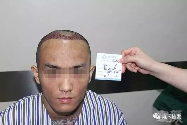 案例图片