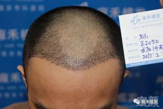 案例图片