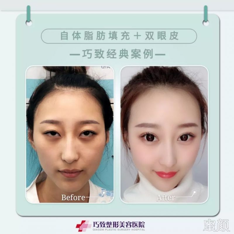 https://img.miyanlife.com/mnt/timg/190523/1213532151-8.jpg