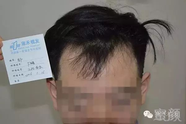 案例图片
