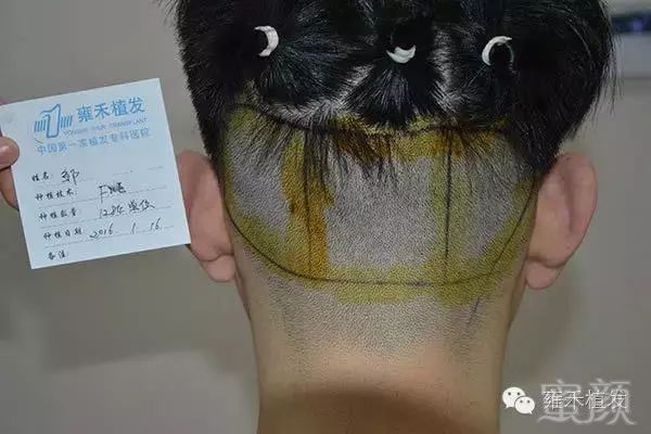 案例图片