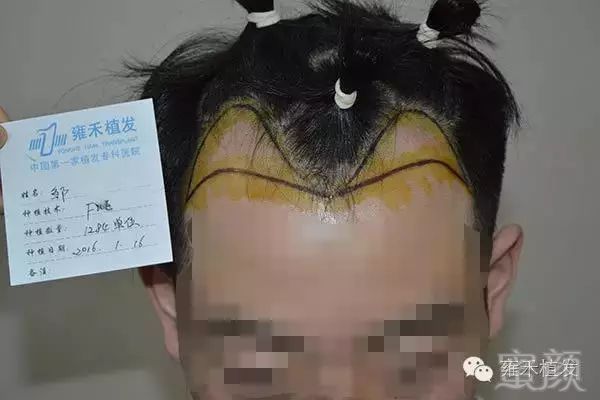 案例图片