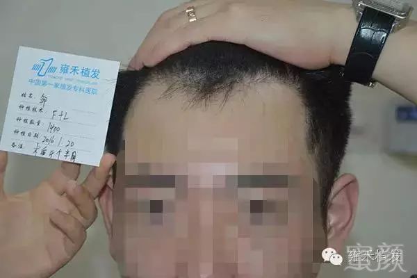 案例图片