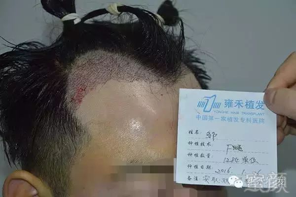 案例图片