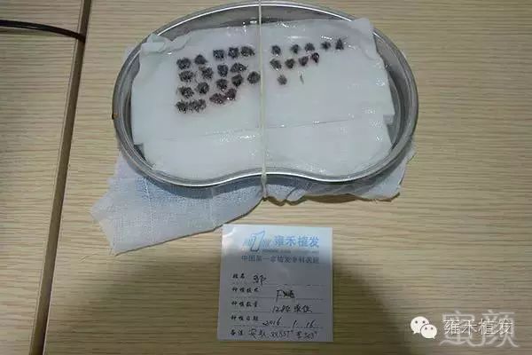 案例图片