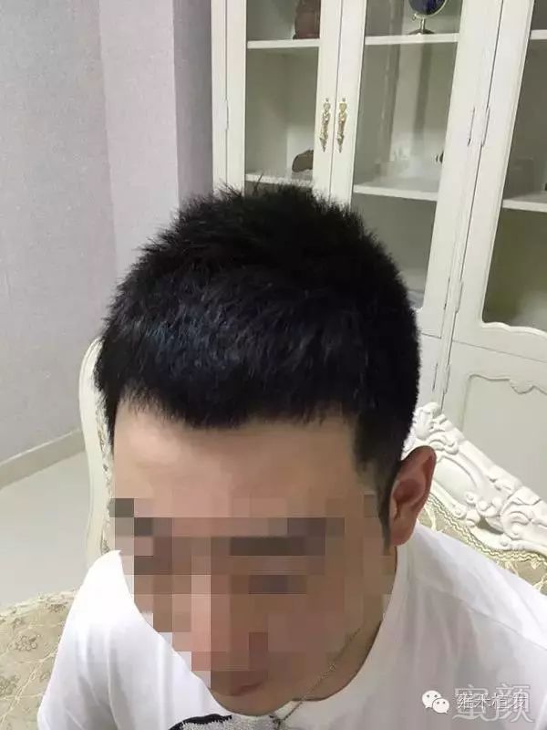 案例图片