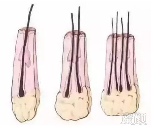 案例图片