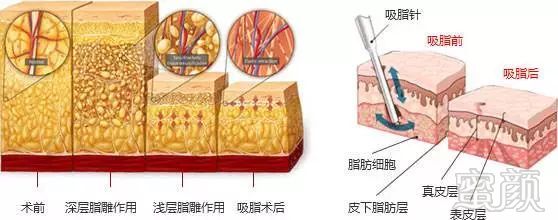 案例图片