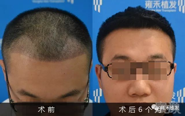 https://img.miyanlife.com/mnt/timg/190525/1200262S2-0.jpg
