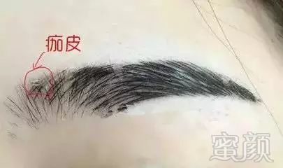 案例图片