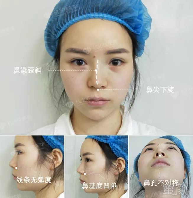 https://img.miyanlife.com/mnt/timg/190526/11293R252-5.jpg
